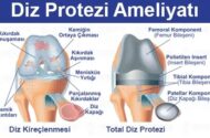 Diz Protezi: Ameliyat Süreci, Fiyatlar, İyileşme ve Tüm Merak Edilenler