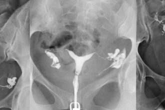 Rahim filmi neden çekilir ve hangi sorunları ortaya çıkarır?