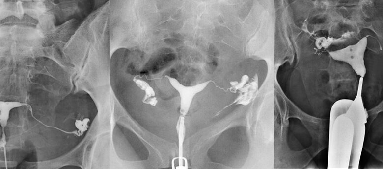  Rahim filmi neden çekilir ve hangi sorunları ortaya çıkarır?